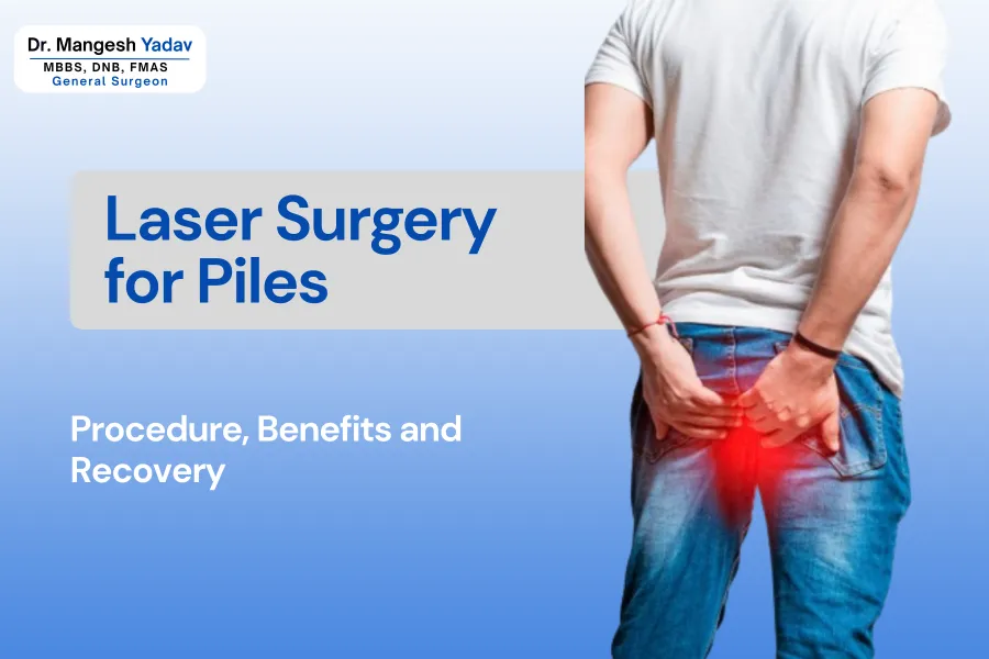 Laser Surgery for Piles in Hadapsar Pune