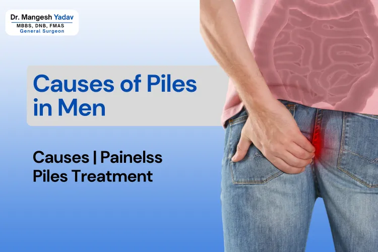 Causes of Piles in Men and treatment