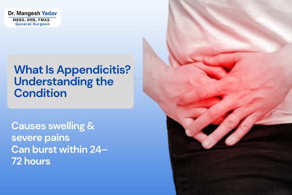 What Is Appendicitis? — Understanding the Condition Appendicitis Treatment in Hadapsar