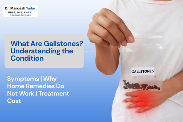 What Are Gallstones? Understanding the Condition