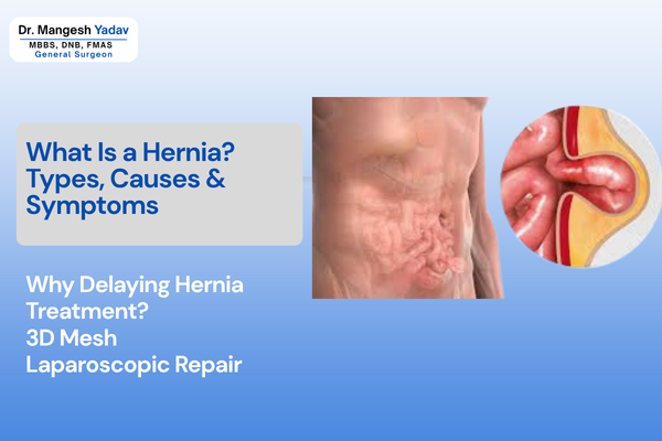 What Is a Hernia? Types, Causes & Symptoms