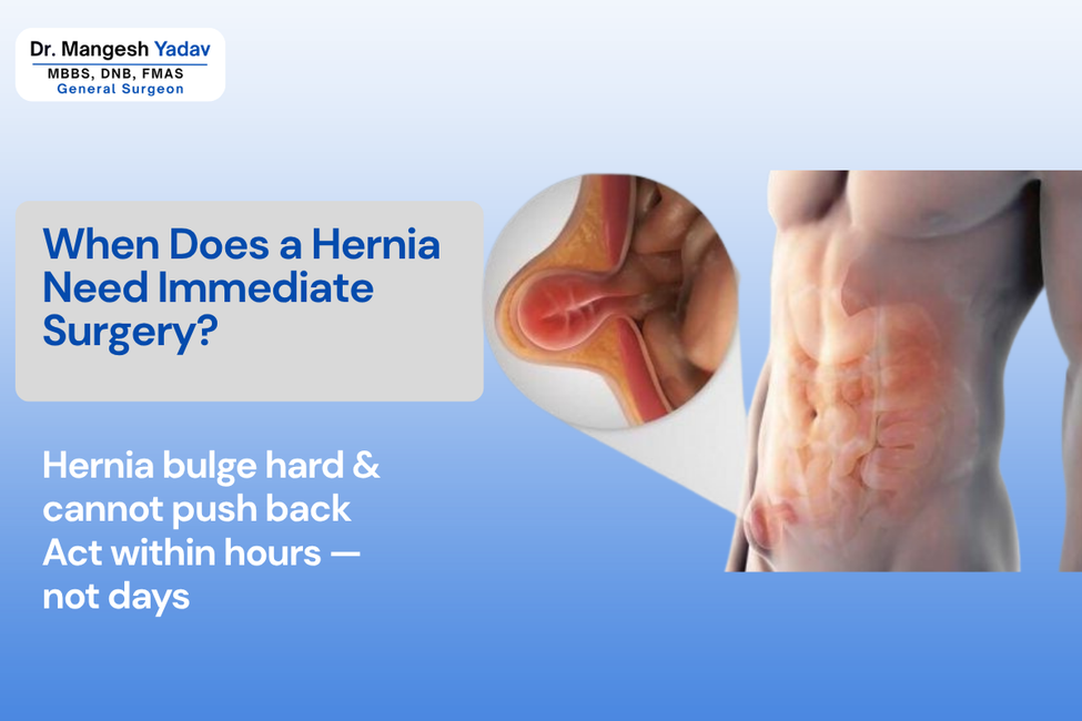 Hernia Treatment in Pune - When Does Hernia Need Immediate Surgery