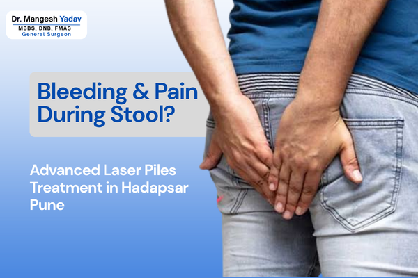 Bleeding & Pain During Stool? Advanced Laser Piles Treatment in Hadapsar Pune