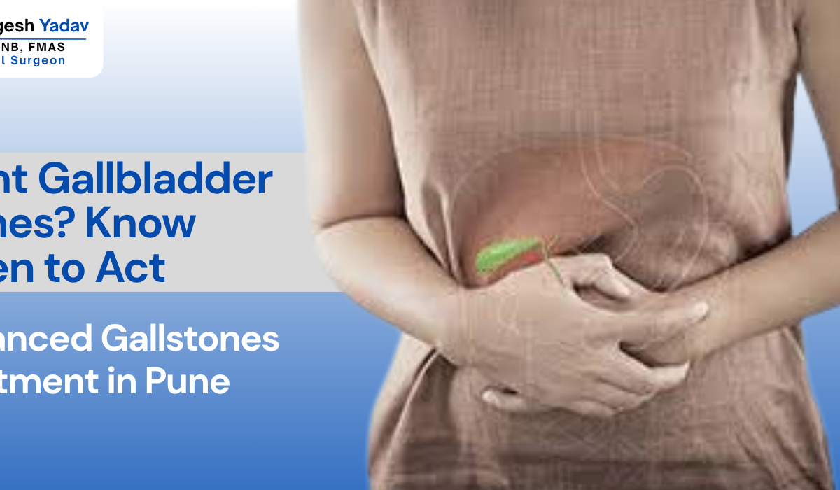 Silent Gallstones Treatment in Pune by Dr. Mangesh Yadav Vishwaraj Hospital