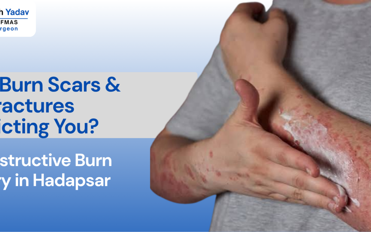 Overcoming Post-Burn Scars and Contractures: Reconstructive Burn Surgery in Hadapsar