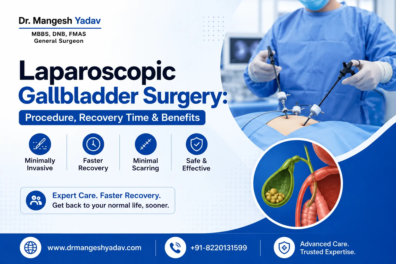 Laparoscopic Gallbladder Surgery in Pune
