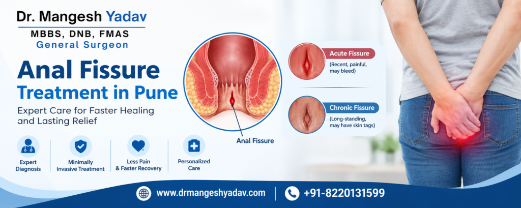 Laser Anal Fissure Treatment in Pune