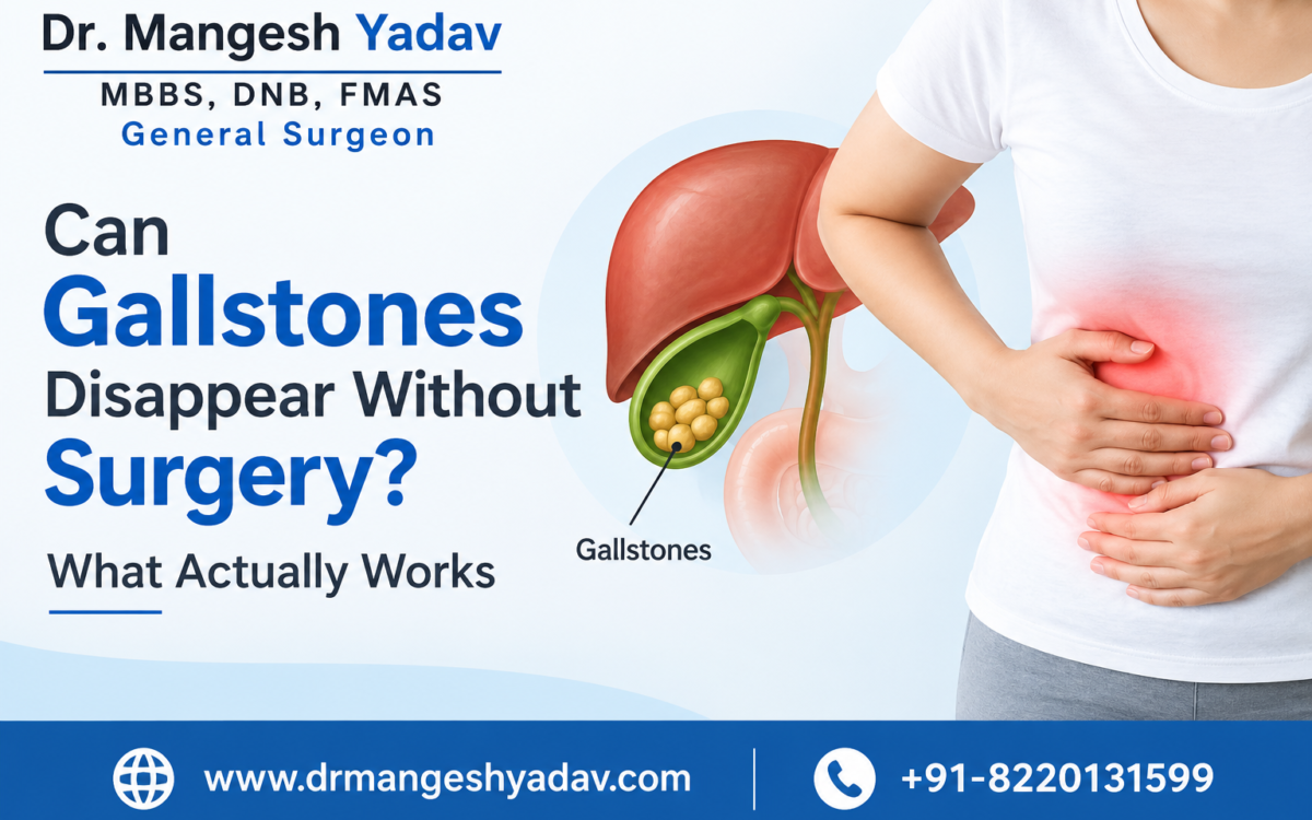 Can Gallstones Disappear WithoutSurgery