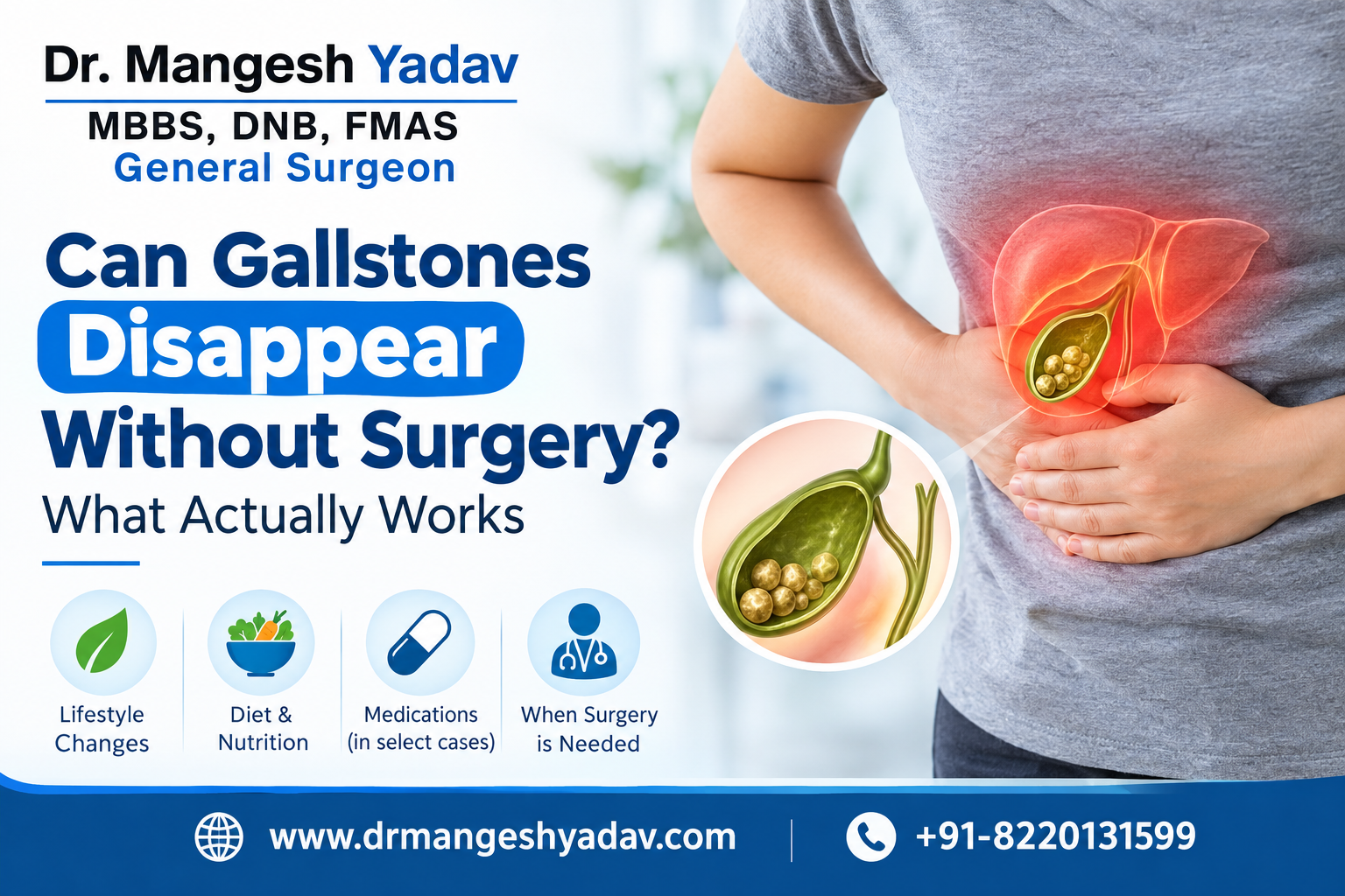 Can gallstones disappear without surgery,