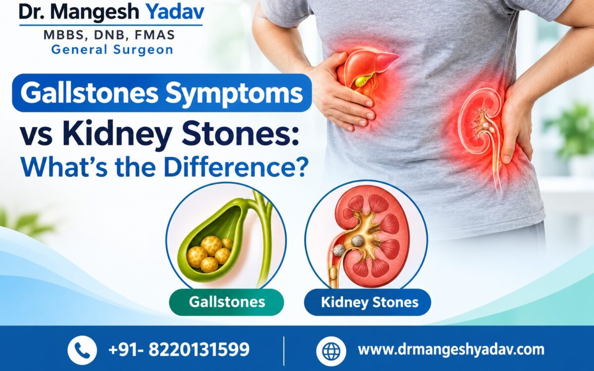 Gallstones Symptoms vs Kidney Stones Whats the Difference-