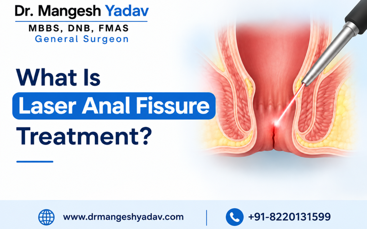 Laser Anal Fissure Treatment