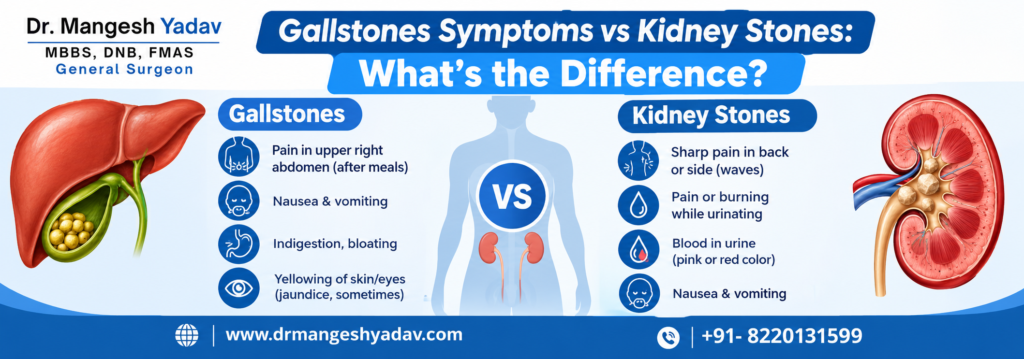 gallstone considered